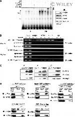 Myc Tag Antibody in Western Blot, ChIP Assay (WB, ChIP)