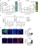Ki-67 Antibody in Immunohistochemistry (IHC)