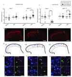 PAX2 Antibody in Immunohistochemistry (IHC)