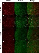 CD11b Antibody in Immunohistochemistry (IHC)