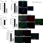 Alpha-Smooth Muscle Actin Antibody in Immunohistochemistry (Paraffin) (IHC (P))