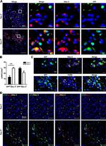 GFP Antibody in Immunocytochemistry (ICC/IF)
