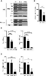 Transferrin Receptor Antibody in Western Blot (WB)