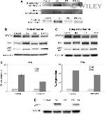 Phospho-c-Raf (Ser621) Antibody in Western Blot, Immunoprecipitation (WB, IP)