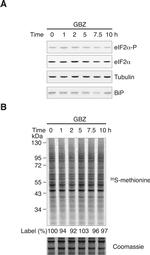 Phospho-EIF2S1 (Ser52) Antibody in Western Blot (WB)
