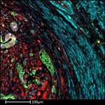 Vimentin Antibody in Immunohistochemistry (Paraffin) (IHC (P))