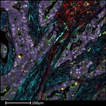 Pan Cytokeratin Antibody in Immunohistochemistry (Paraffin) (IHC (P))