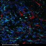 Collagen IV Antibody in Immunohistochemistry (Paraffin) (IHC (P))