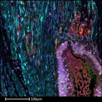 CD8 alpha Antibody in Immunohistochemistry (Paraffin) (IHC (P))