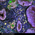 CD8 alpha Antibody in Immunohistochemistry (Paraffin) (IHC (P))