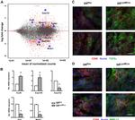 MMP13 Antibody in Immunocytochemistry (ICC/IF)