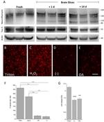 Tau Antibody in Western Blot (WB)