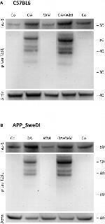 Tau Antibody in Western Blot (WB)
