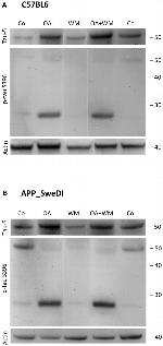 Tau Antibody in Western Blot (WB)