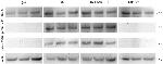 Tau Antibody in Western Blot (WB)
