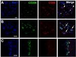 CD86 (B7-2) Antibody in Immunohistochemistry (IHC)