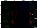 Phospho-Tau (Ser202, Thr205) Antibody in Immunohistochemistry (IHC)