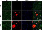 Phospho-Tau (Ser202, Thr205) Antibody in Immunohistochemistry (IHC)