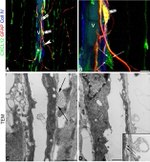 GFAP Antibody in Immunohistochemistry (IHC)
