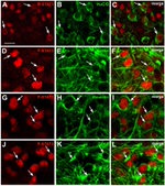 HuC/HuD Antibody in Immunohistochemistry (IHC)