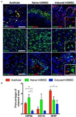 GFAP Antibody in Immunohistochemistry (IHC)