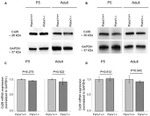 Connexin 30 Antibody in Western Blot (WB)