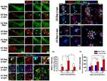 HuC/HuD Antibody in Immunohistochemistry (IHC)