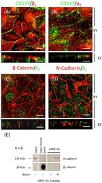 N-cadherin Antibody in Western Blot, Immunocytochemistry (WB, ICC/IF)