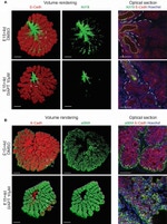 E-cadherin Antibody in Immunohistochemistry (IHC)