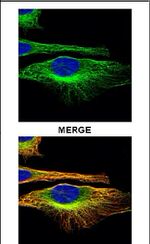 Actin Antibody in Immunocytochemistry (ICC/IF)