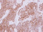 Actin Antibody in Immunohistochemistry (IHC)