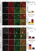 Ki-67 Antibody in Immunohistochemistry (IHC)