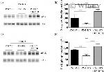 Phospho-SRC (Tyr419) Antibody in Western Blot (WB)