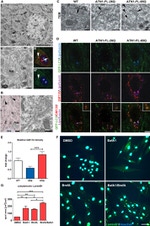 GFP Antibody in Immunocytochemistry (ICC/IF)
