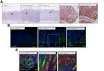 Ki-67 Antibody in Immunohistochemistry (IHC)