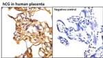 hCG Antibody in Immunohistochemistry (Paraffin) (IHC (P))