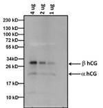 hCG Monoclonal Antibody (SC2)
