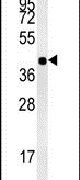 ISPD Antibody in Western Blot (WB)