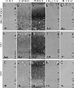 Phospho-Tau (Thr212, Ser214) Antibody in Immunohistochemistry (IHC)