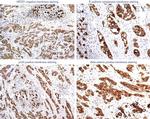 E-cadherin Antibody in Immunohistochemistry (IHC)