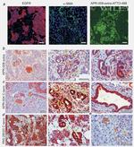 EGFR Antibody in Immunohistochemistry (Paraffin) (IHC (P))