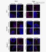 Occludin Antibody in Immunohistochemistry (IHC)