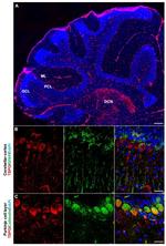 GFAP Antibody in Immunohistochemistry (IHC)