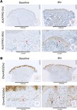 CMKLR1 Antibody in Immunohistochemistry (Paraffin) (IHC (P))