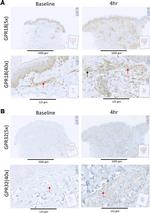 GPR32 Antibody in Immunohistochemistry (Paraffin) (IHC (P))