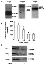 PAX2 Antibody in Western Blot (WB)