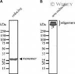 MBL2 Antibody in Western Blot (WB)