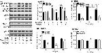 ALK Antibody in Western Blot (WB)