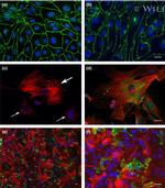 ZO-1 Antibody in Immunocytochemistry (ICC/IF)