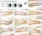 HuC/HuD Antibody in Immunohistochemistry (IHC)